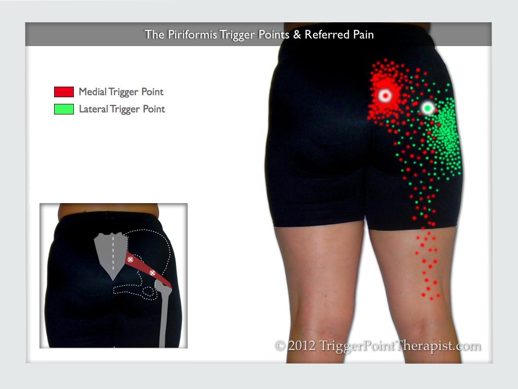 ANMOIST Piriformis Ball 2.5'' Trigger Point Massage Relief for Hip Pain,  Sciatica