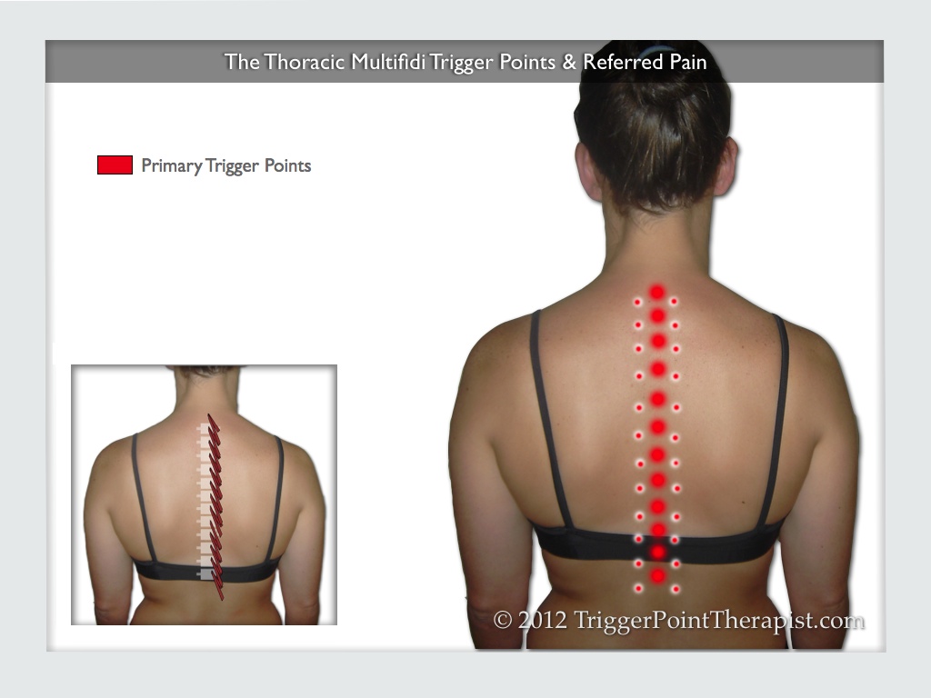 Trigger Point Back Rocker, Spine, Pain Relief