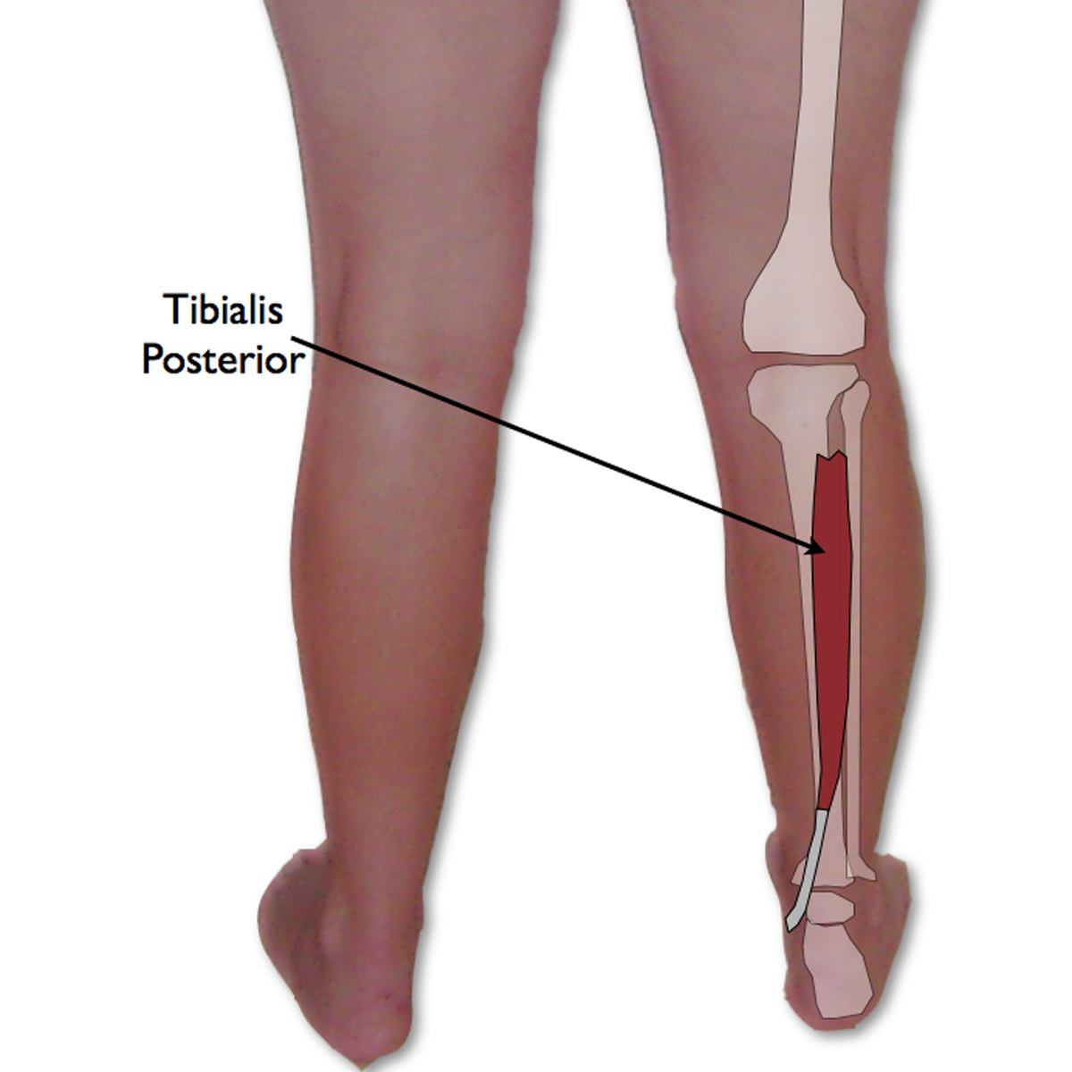 tibialis-posterior-trigger-point-runner-s-achilles-tendonitis