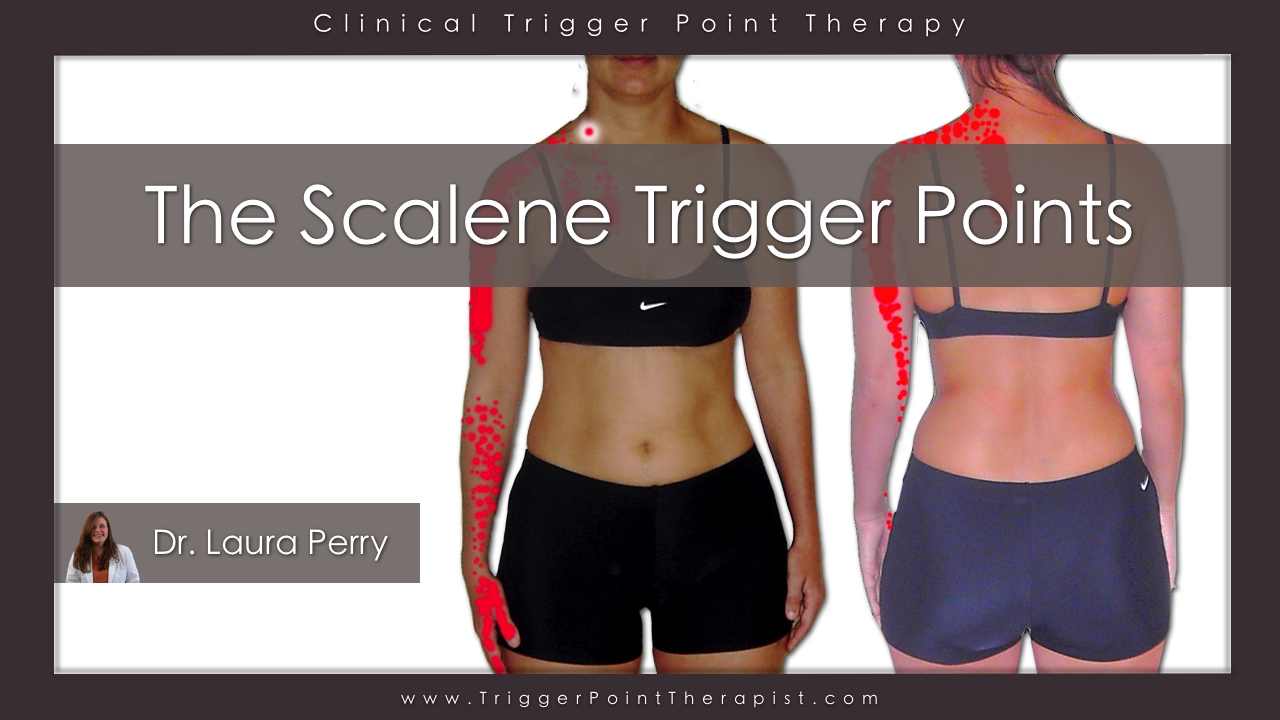 The Scalene Trigger Points Upper Body Troublemakers