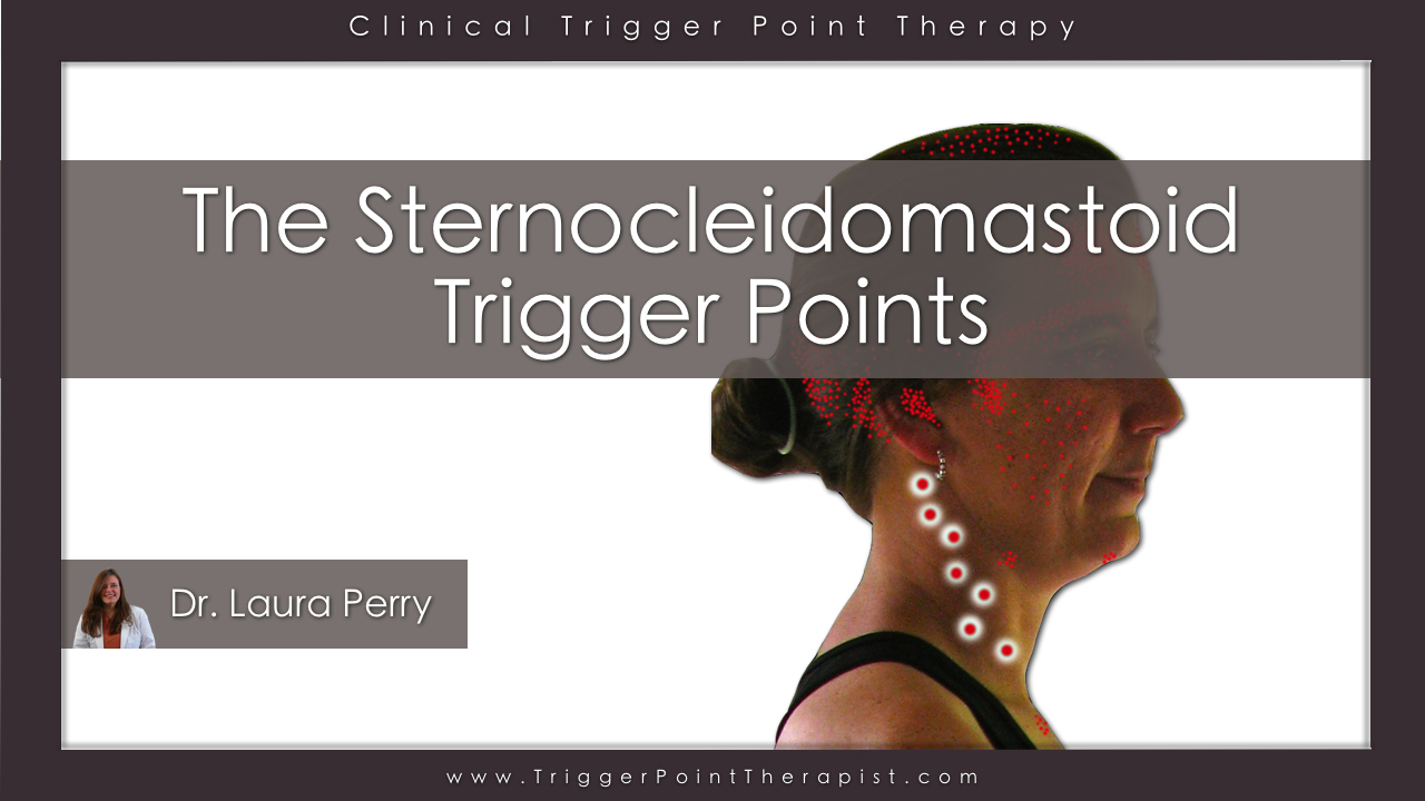 Sternocleidomastoid Trigger Points Master Of The Migraine 7131