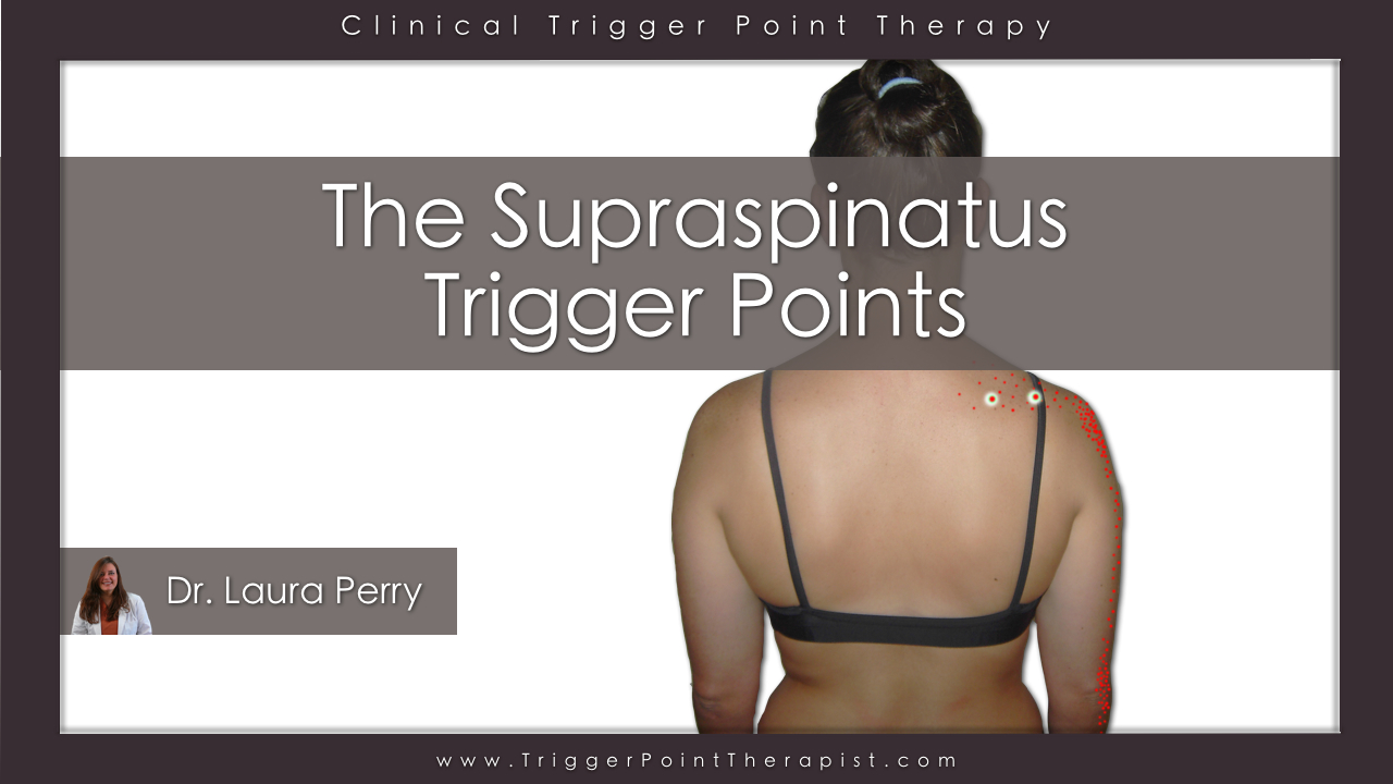 Supraspinatus Trigger Points Treating The “stubborn Atus” 4292