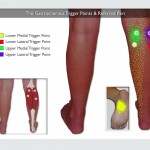 Trigger Point Therapy Blog | TriggerPointTherapist.com