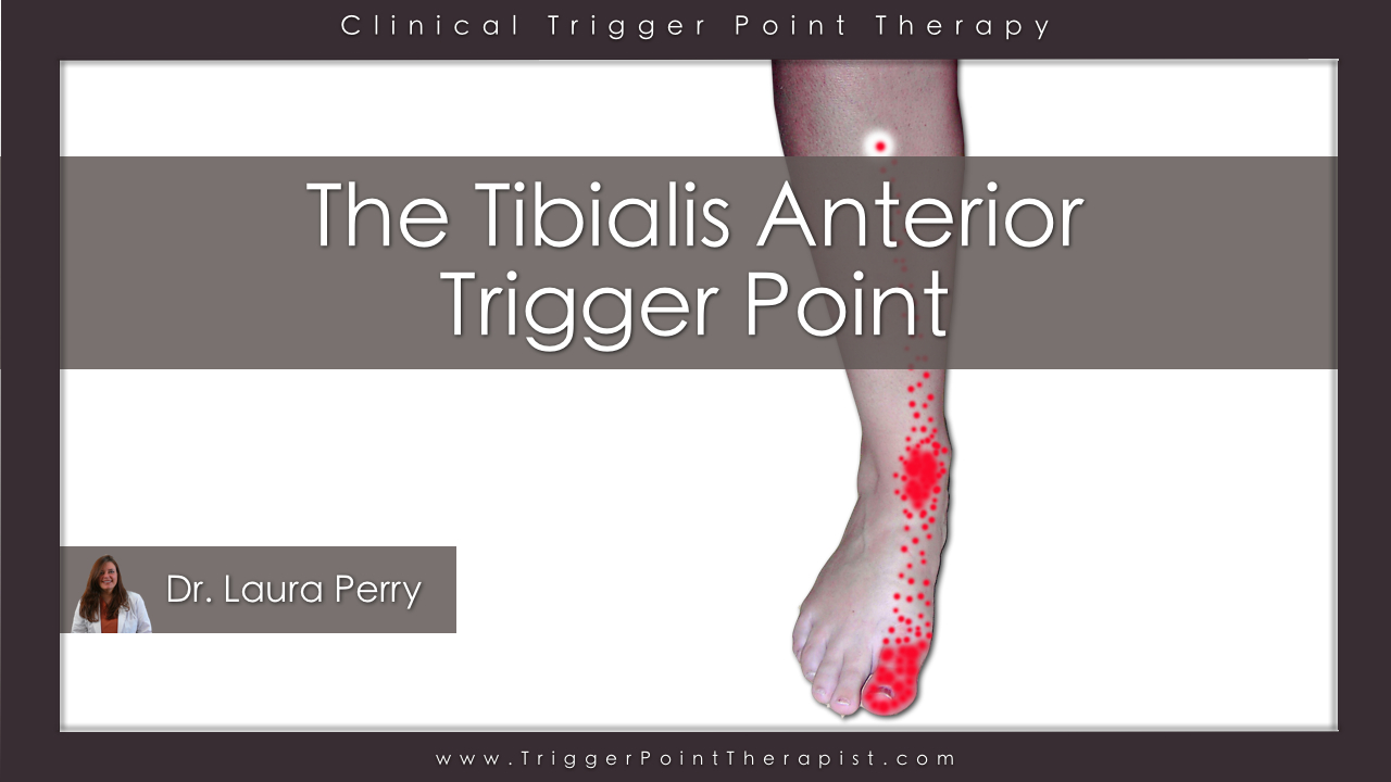 Tibilais Anterior Trigger Point: The Foot Drop Trigger Point ...